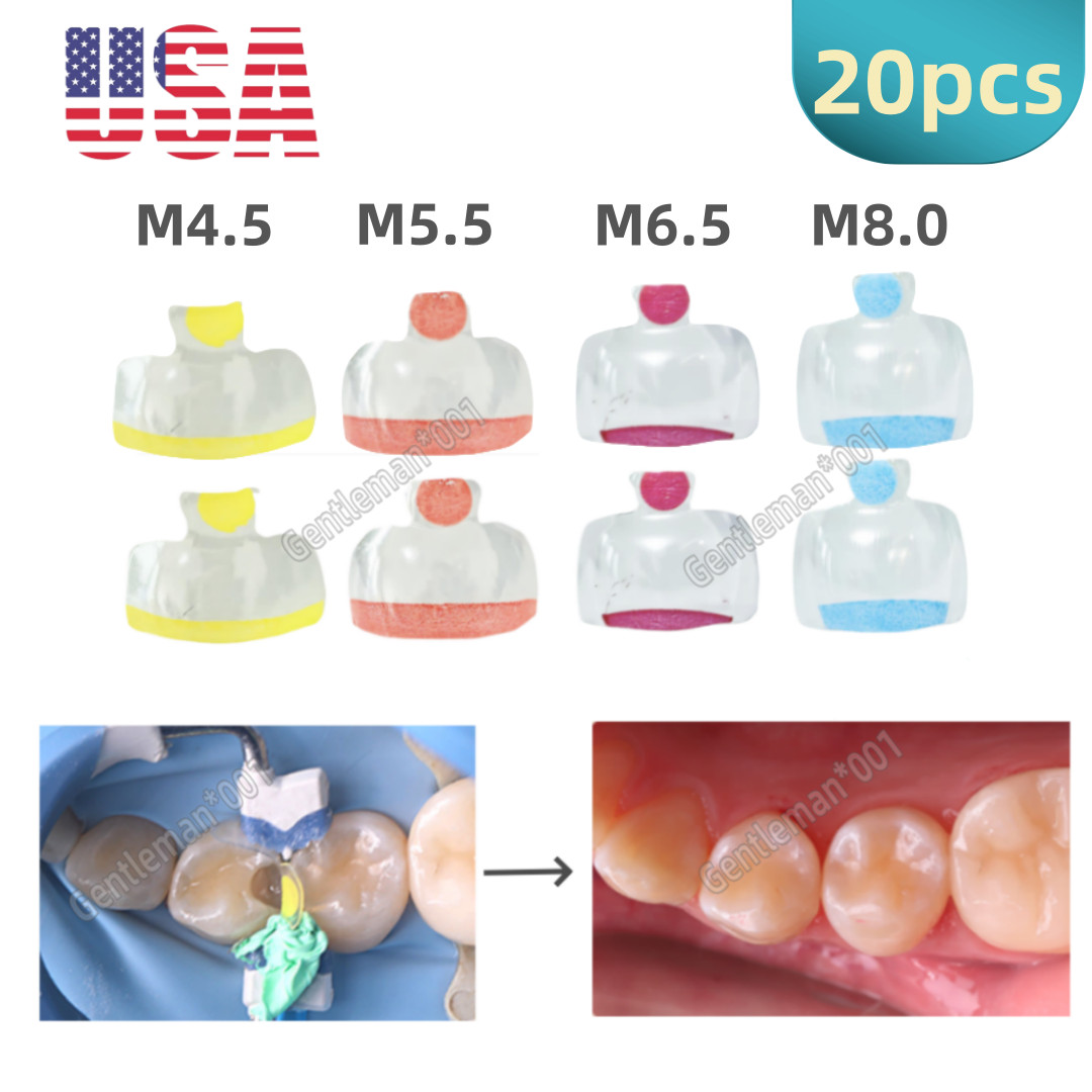 20Pcs Dental Clear Matrix Molar Mylar Matrices Similar Bioclear Matrice M4.5-8.0