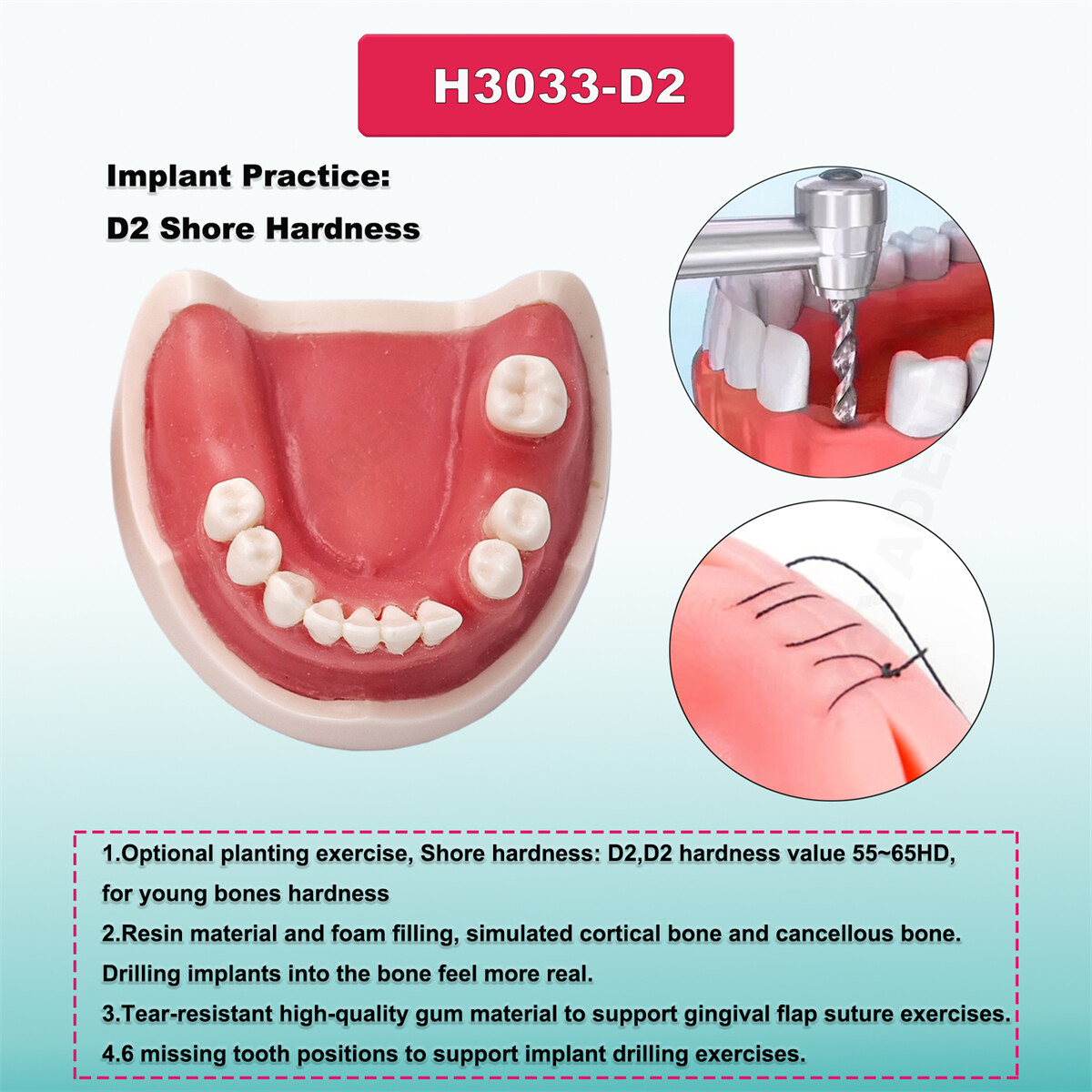 US Dental Typodont Teeth Model Ortho Overdenture Implant Practice Teaching Demo