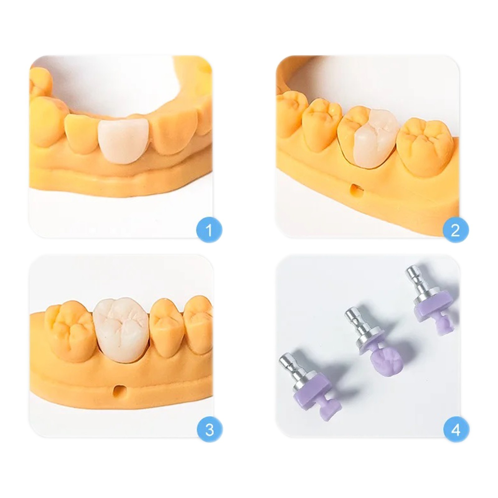 US Dental Lithium Disilicate Block Emax Chairside CAD/CAM CEREC Ceramic Material