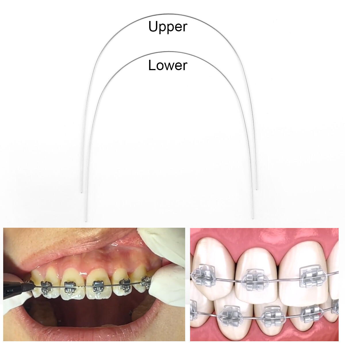 Dental Orthodontic Self Ligating Brackets Super Elastic NiTi Arch Wire Roth 022