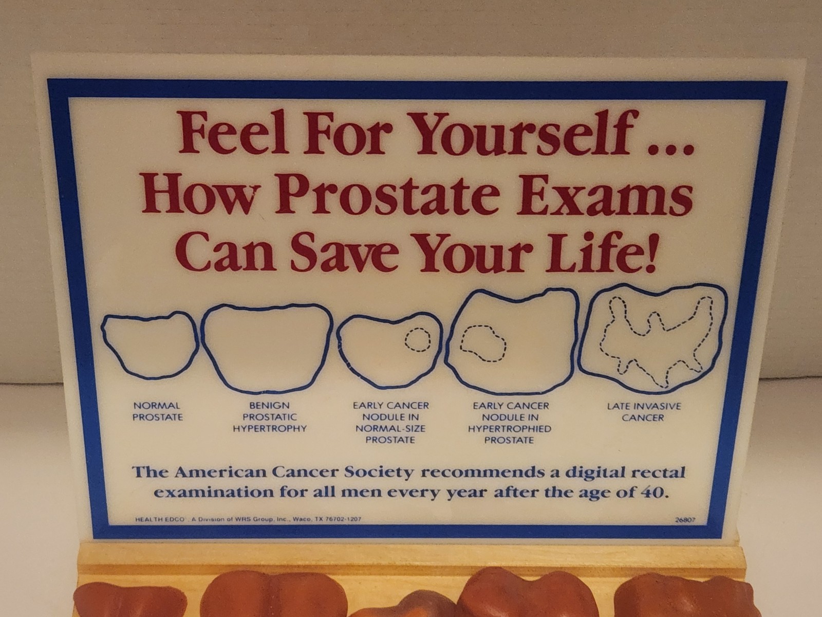 Prostate exam chart and touch