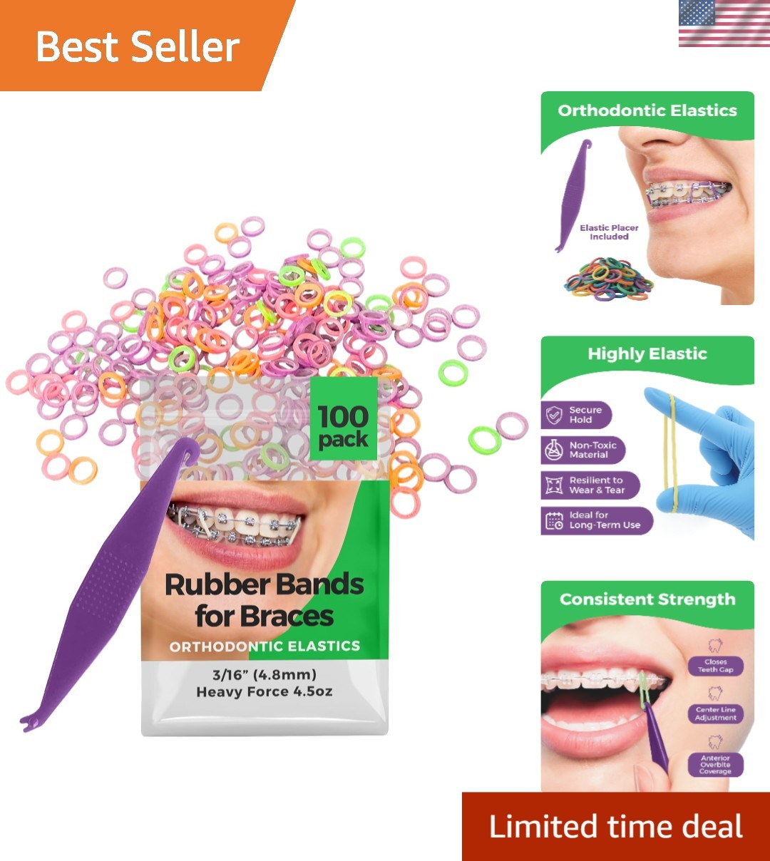 3/16 Inch Heavy Force Orthodontic Rubber Bands – 100 Pack with Free Placer Tool