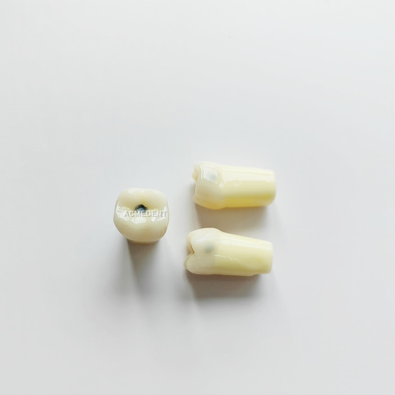 Dental Vitro Teeth Decay Caries Tooth Model Dentist Student #36 Fits Nissin ADC