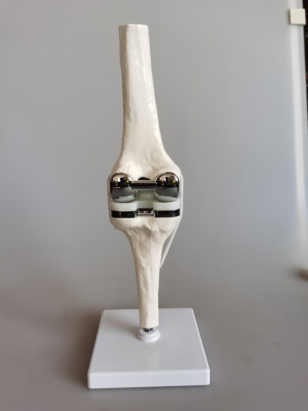 Detachable Artificial Knee Prosthesis Medical Anatomical Teaching Demo Model