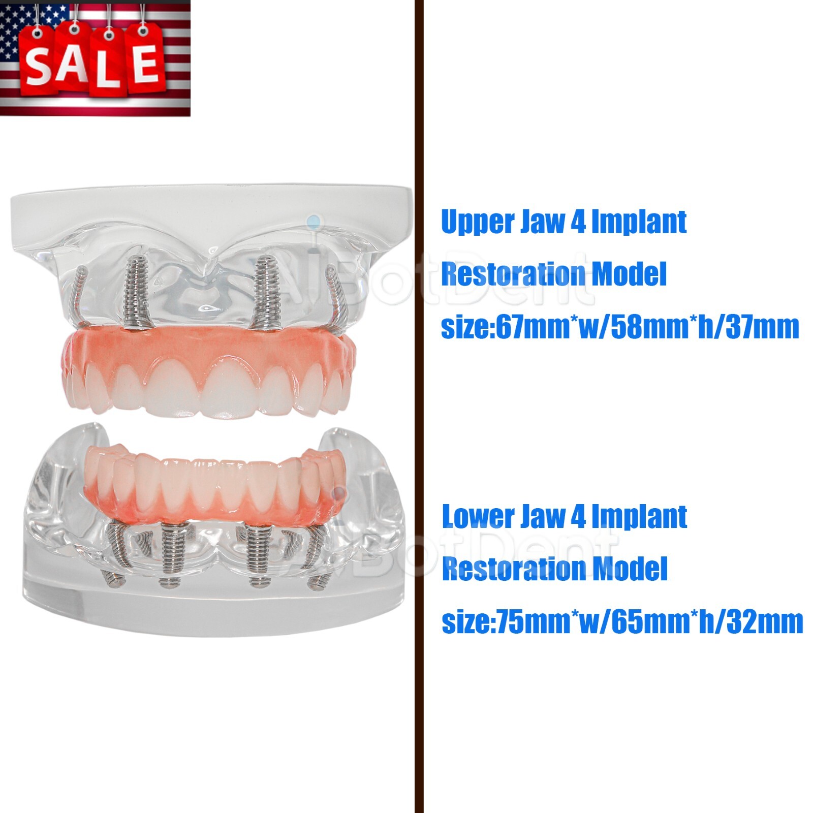 Dental All-on-4 Implant Models M6001-1/M6027 Clear Jaws 4 Screws Removable Teeth