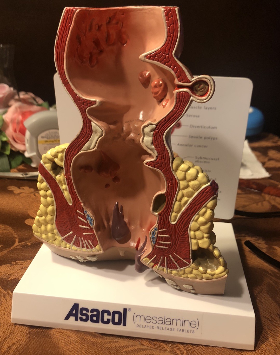 Rectum Anatomical Model – New With Card to Identify Abnormalities. Asacol