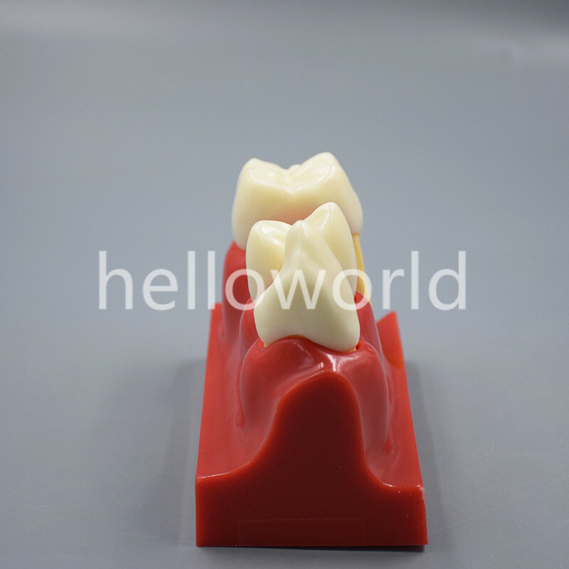 Dental Endodontic Study Teeth Model 4 Times Tooth Anatomy Anatomical Models