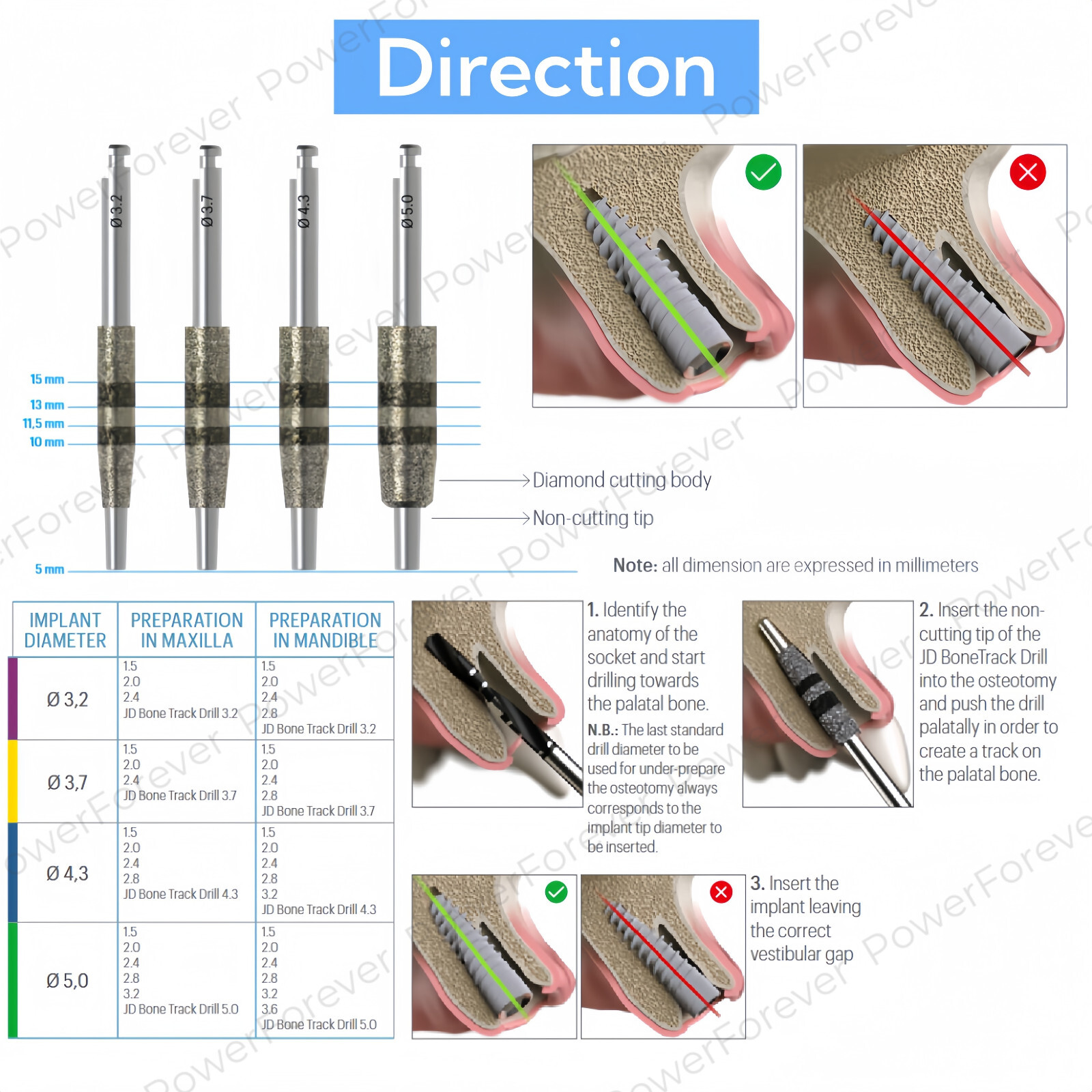 1Kit Dental Bone Track Drill Kit JD Guided Neck Correction Drills Diamond Cut