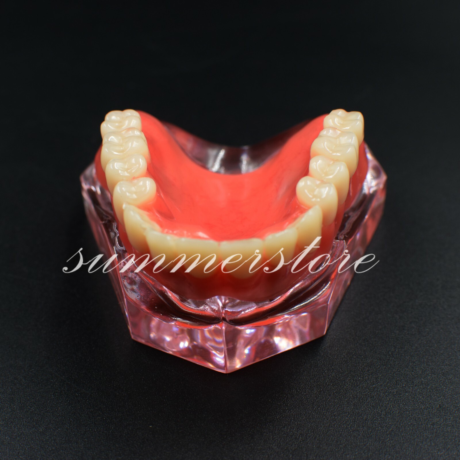 Dental Restoration Overdenture Inferior Implant Demo Teeth Model 7 Type Optional