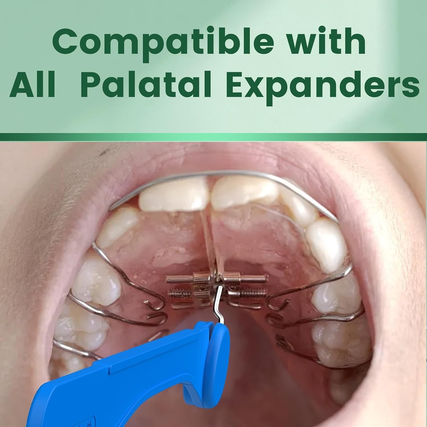 2 Count Universal Expander Keys, Dental Orthodontic Expansion Key Tool for Pa…