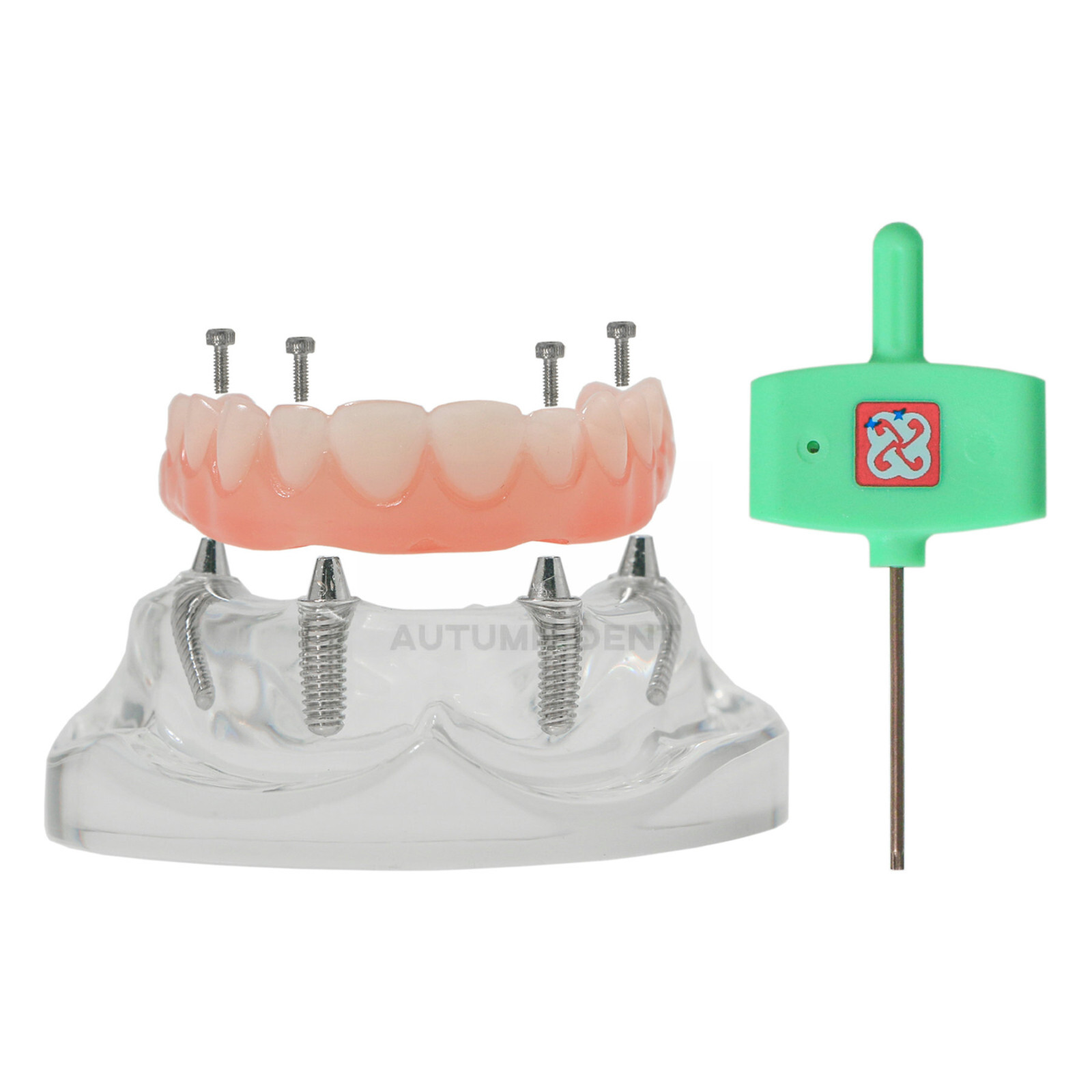US Dental Overdenture Implant Model All-on-4 With 4 Screw Upper/Lower Clear Jaw