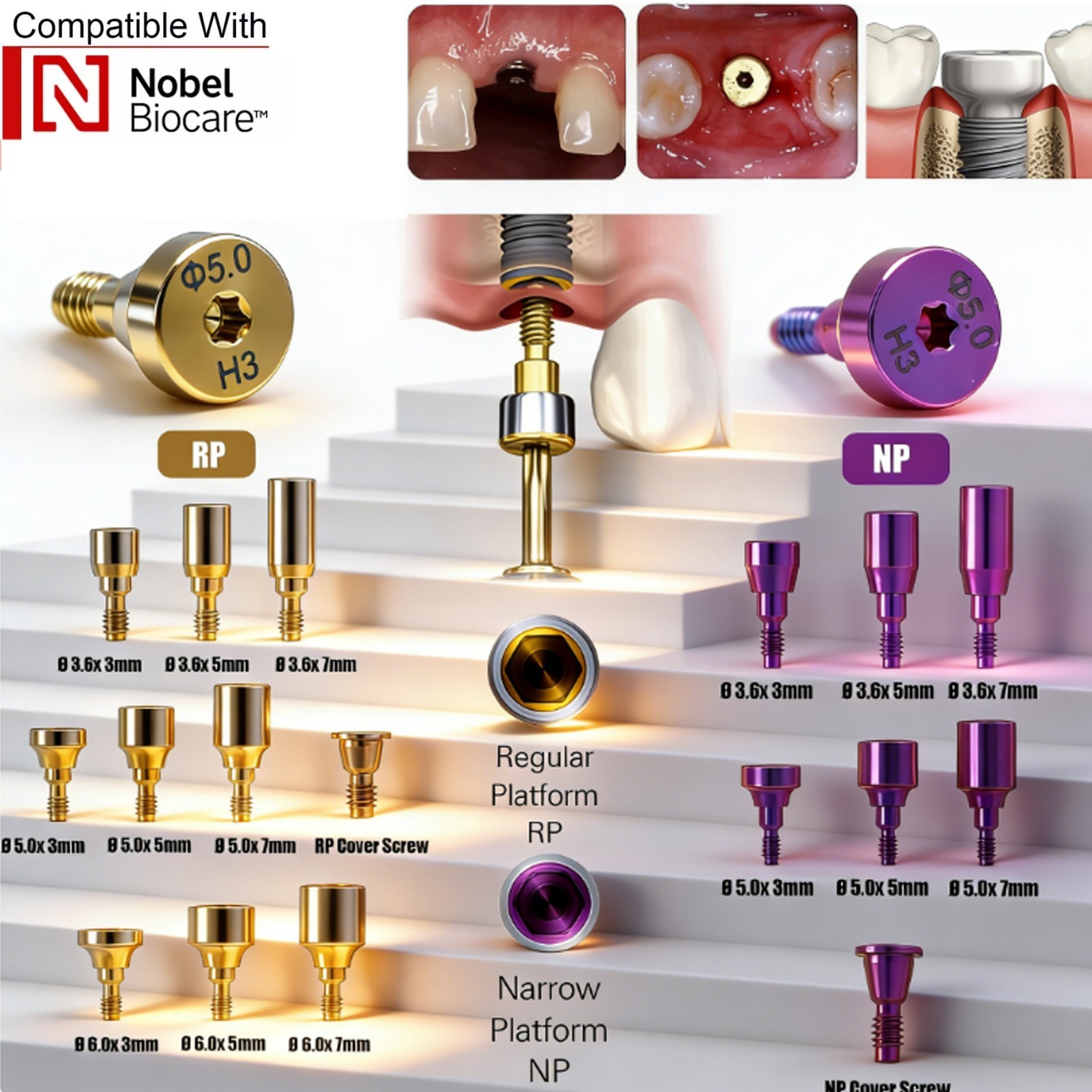 5Pcs Nobel active Healing Abutment Cover Screw Healing Screw Gum Molding Implant