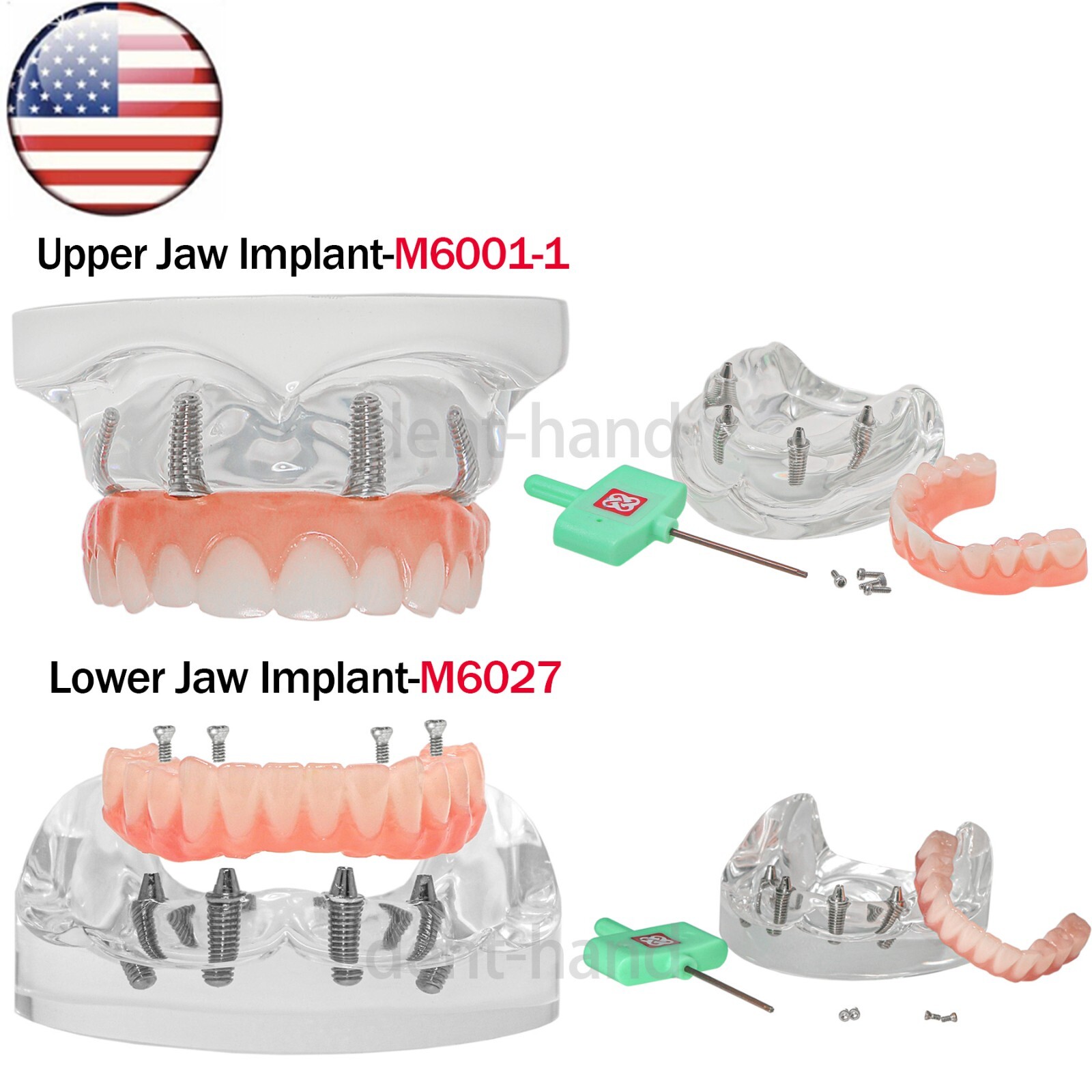 US Dental Overdenture Implant All-on-4 Upper/Lower Clear Jaw Model With 4 Screws