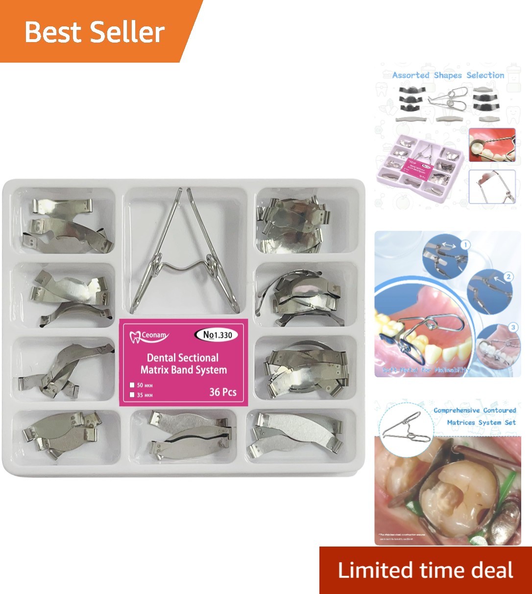 Durable 36-Piece Stainless Steel Dental Restoration Bands with 0.035mm Thickness