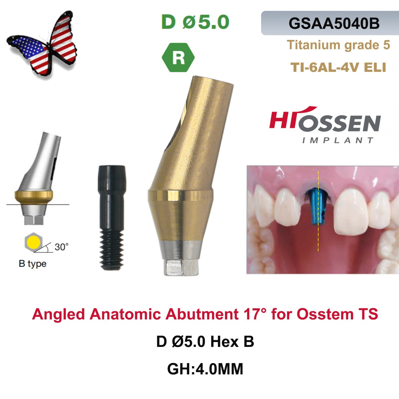 Dental 17° Angled Abutment Regular Ø5.0mm Hex A/B GH2/4 Fit Osstem TS Hiossen ET