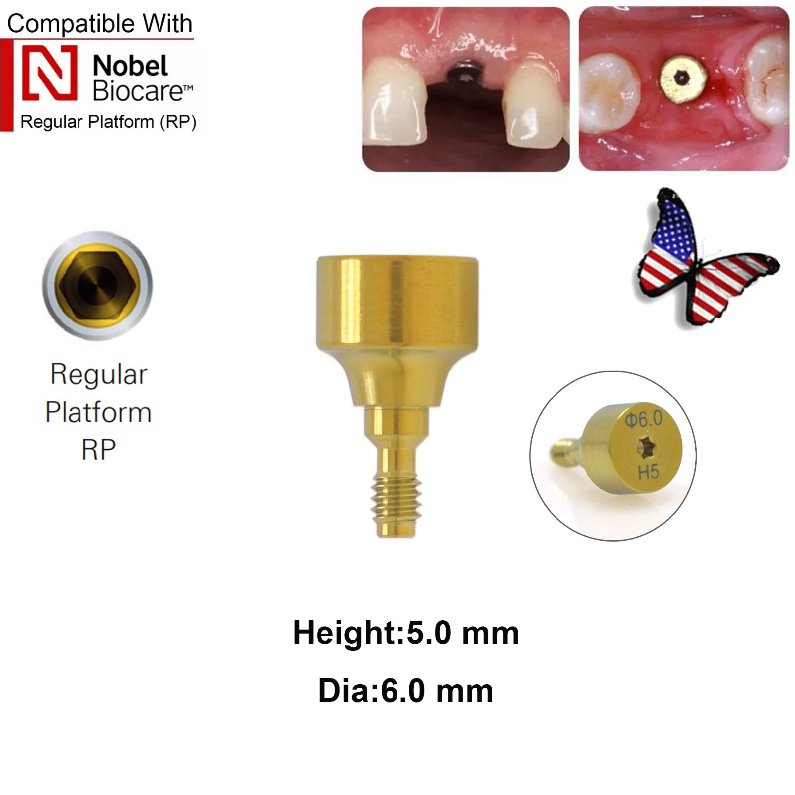 5Pcs Nobel active Healing Abutment Cover Screw Healing Screw Gum Molding Implant
