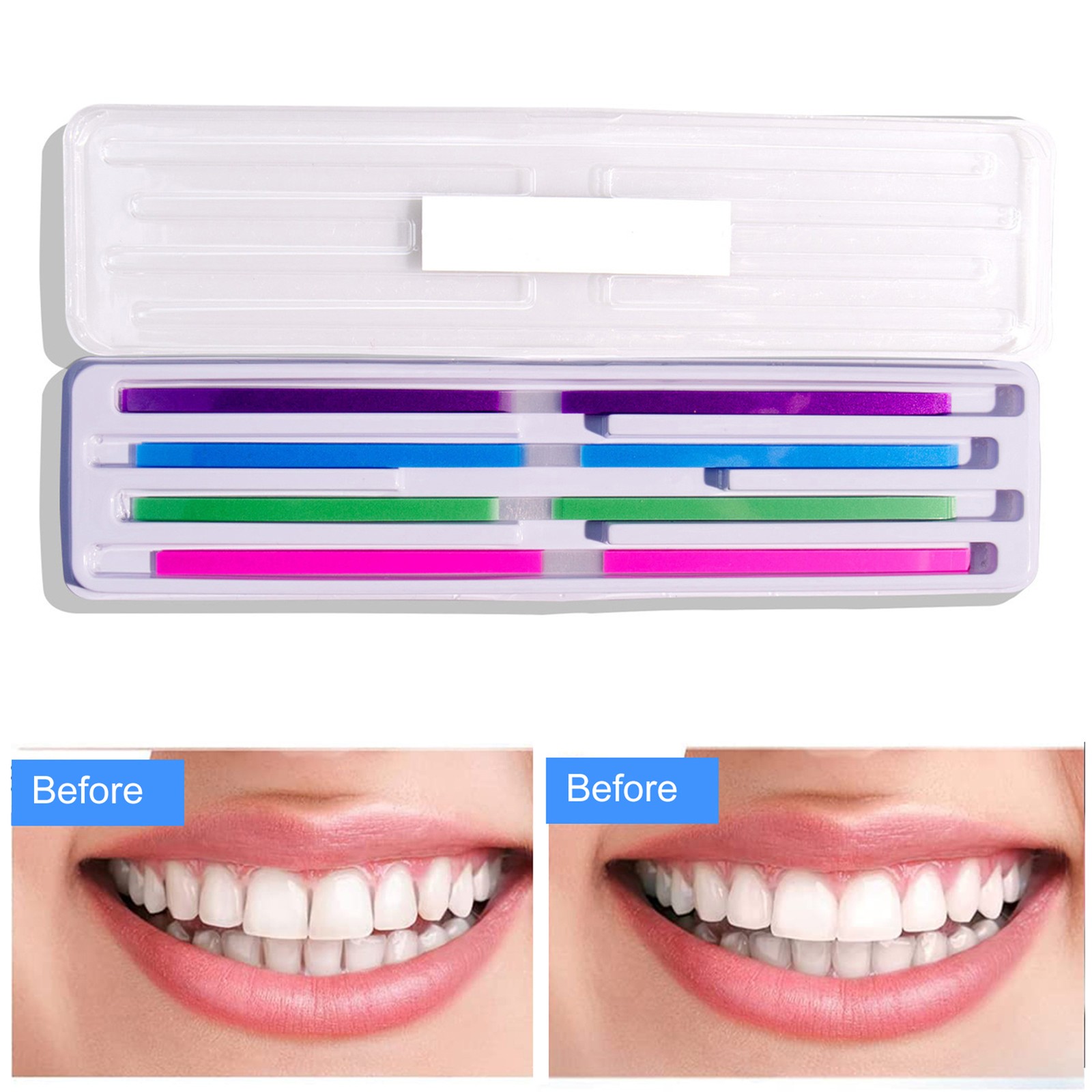 60Pcs/Pack Dental Polishing Strips Teeth Polishing Finishing Kit DLTA
