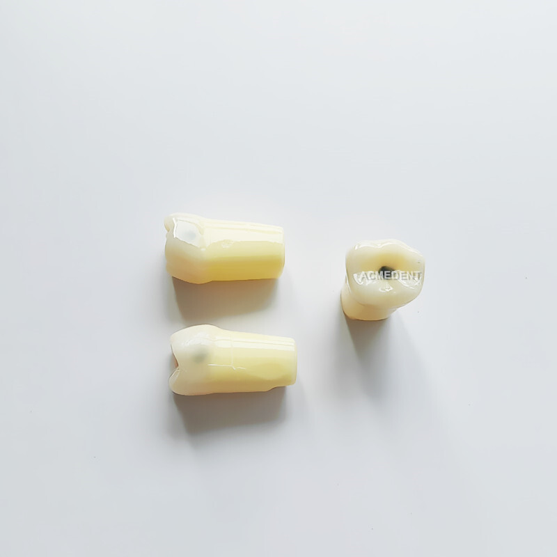 Dental Vitro Teeth Decay Caries Tooth Model Dentist Student #36 Fits Nissin ADC