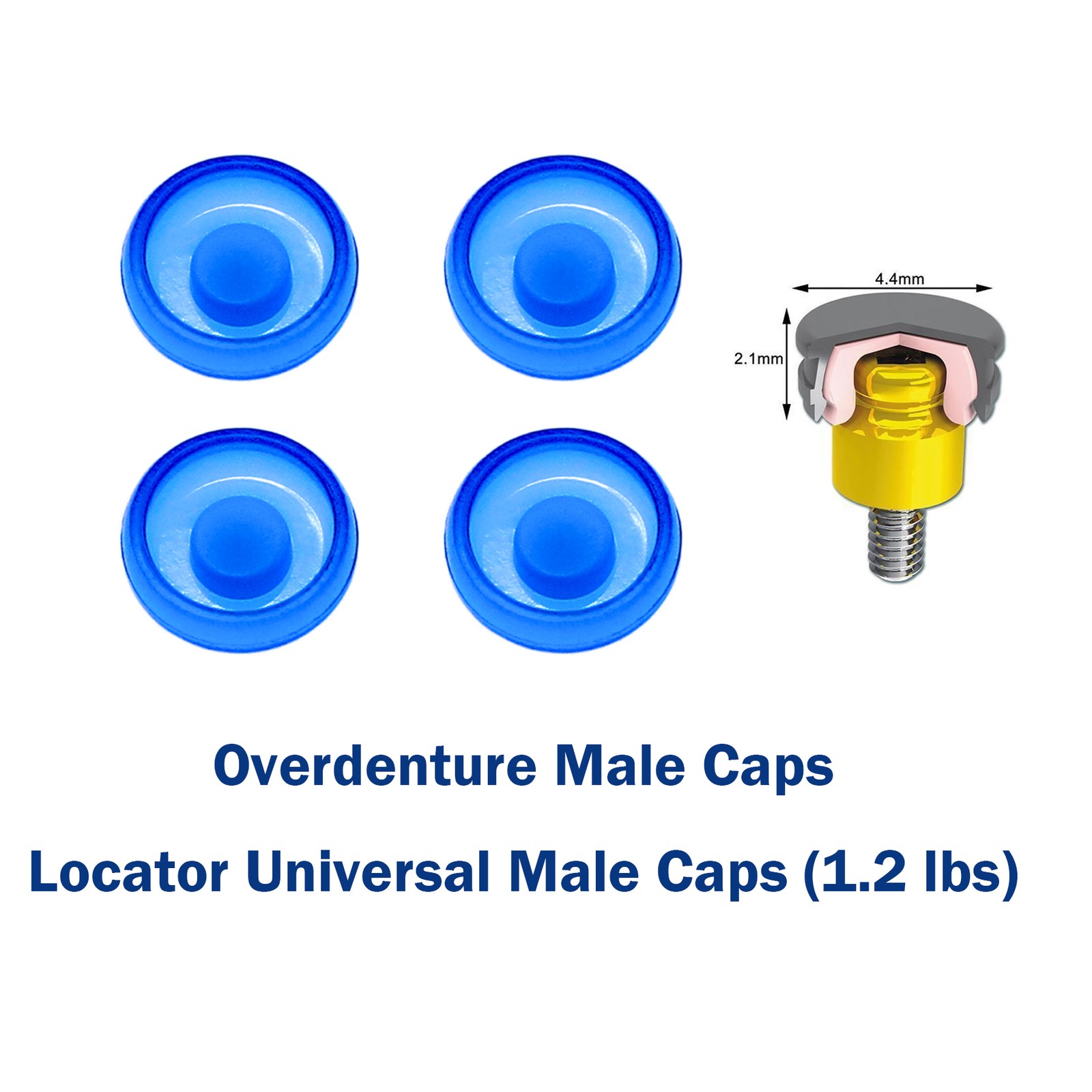 US Dental Locator Overdenture Abutment & Caps Fits Nobel/Hiossen/Zimmer/MIS/TSV