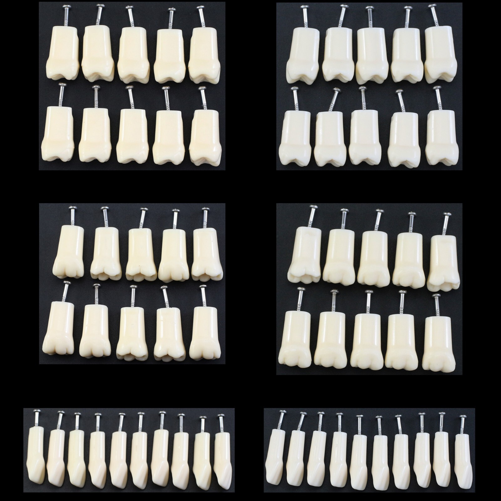 10PCS Kilgore Nissin 200 Dental Replacement Teeth Model Typodont #11 #16 #26 #36