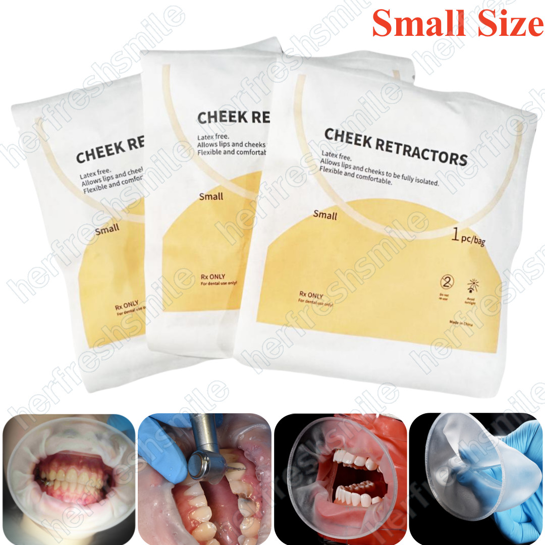 Dental Mouth Opener Lip Cheek Retractors O Shape Intraoral Lip Expander Opener S