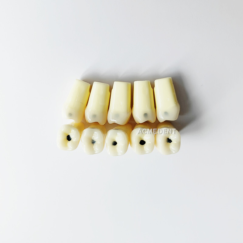 Dental Molar Vitro Teeth Decay Caries Tooth Model Dentist Student Practise Test