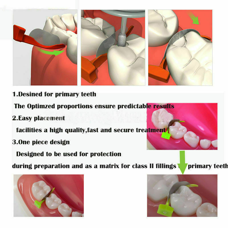 Dental Interproximal Wedges Plastic Concave Matrix Diastema Fender Blade w Hole