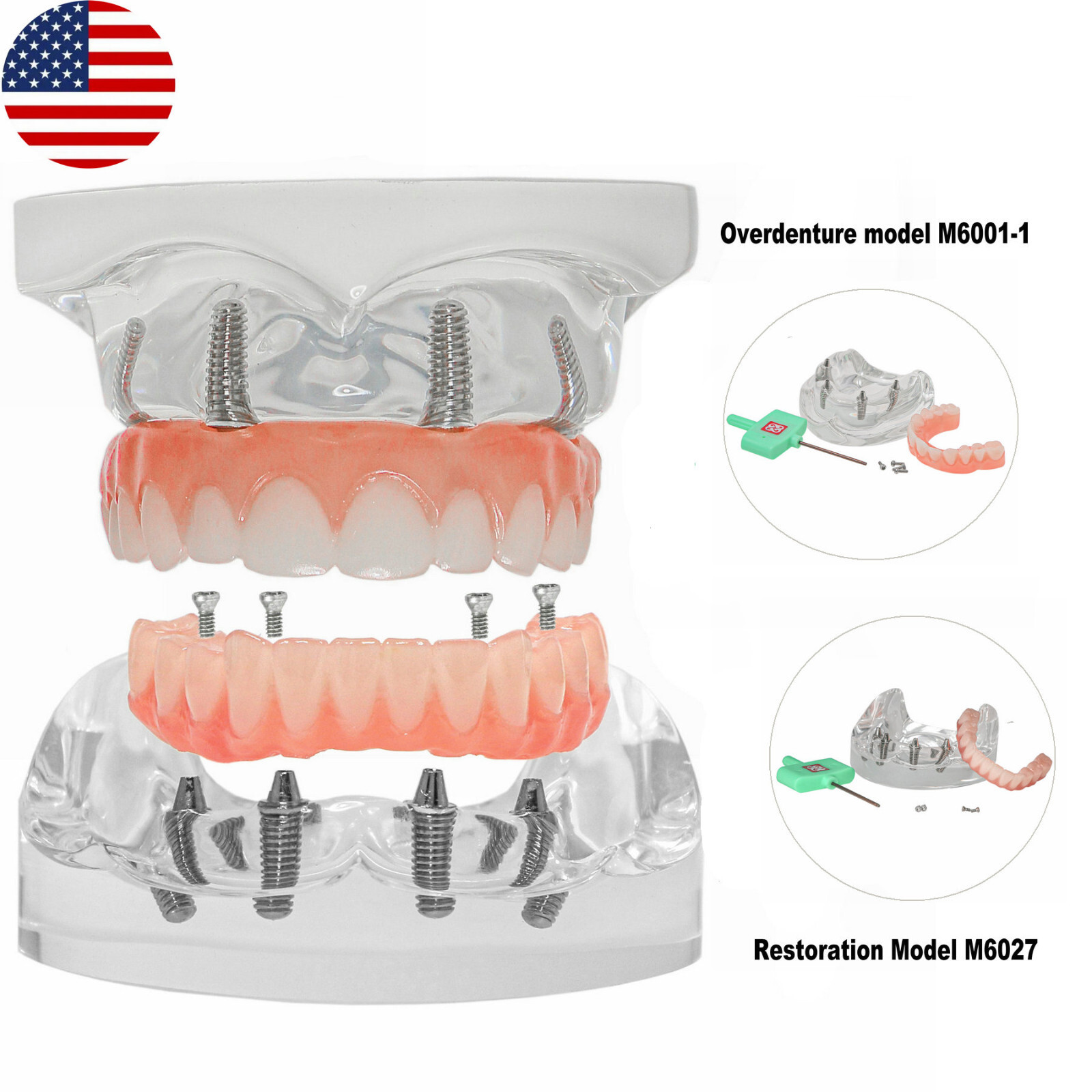 US Dental Overdenture Implant Model All-on-4 With 4 Screw Upper/Lower Clear Jaw