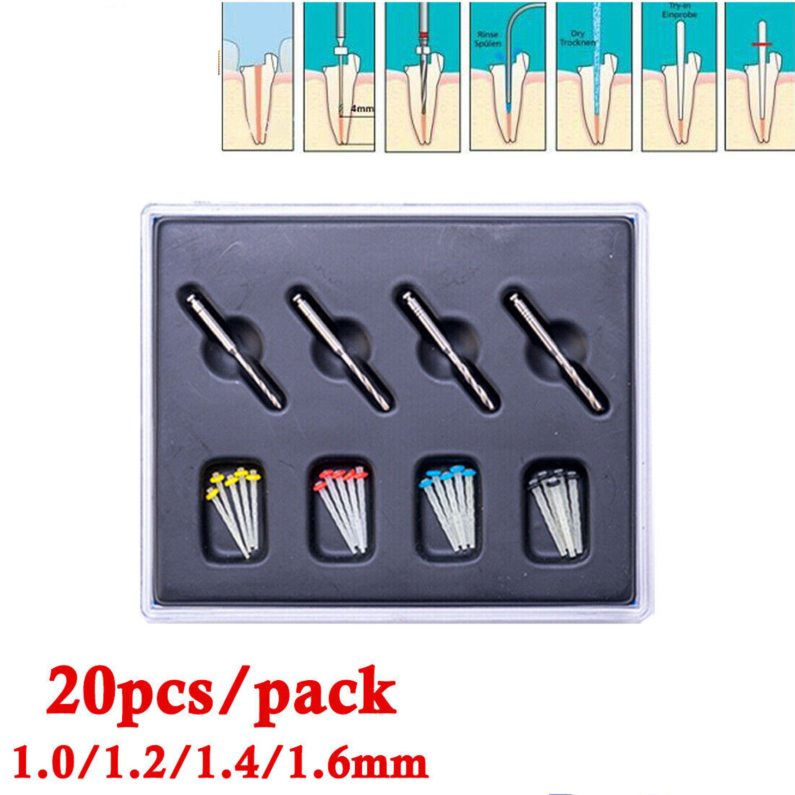 Dental Fiber Post Glass Quartz Teeth Restorative Root Canal Pins 1/1.2/1.4/1.6mm