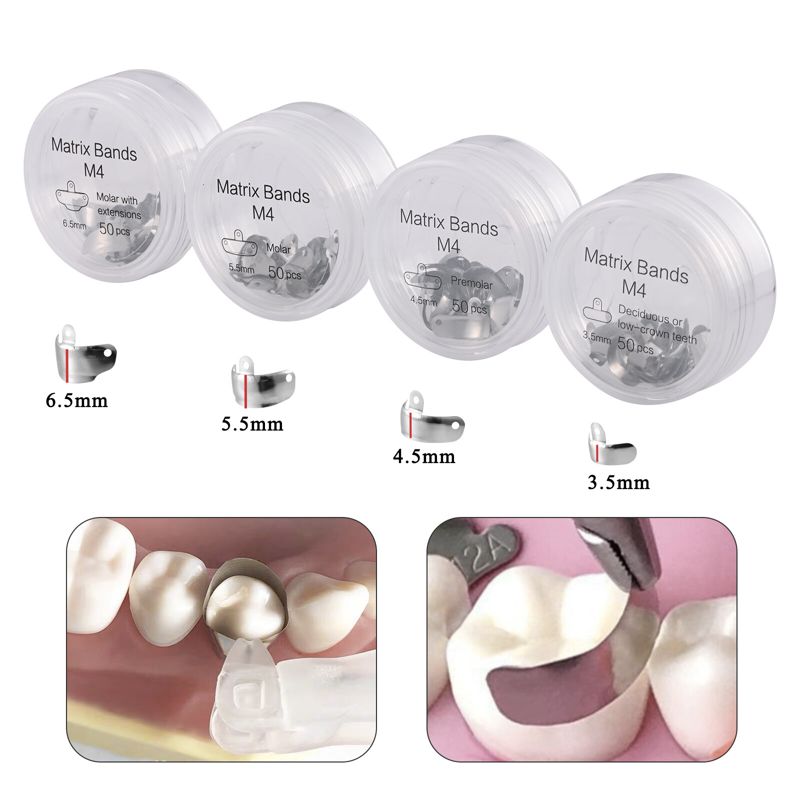 50Pcs Dental Matrix Bands Palodent V3 Style Sectional Contoured Matrices 4 Size