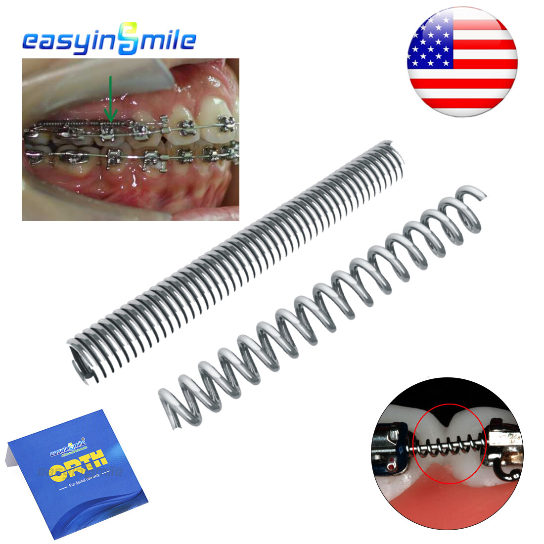 Easyinsmile Orthodontic Open Coil Spring Dental NITI Alloy 010/012” 180mm 2pcs