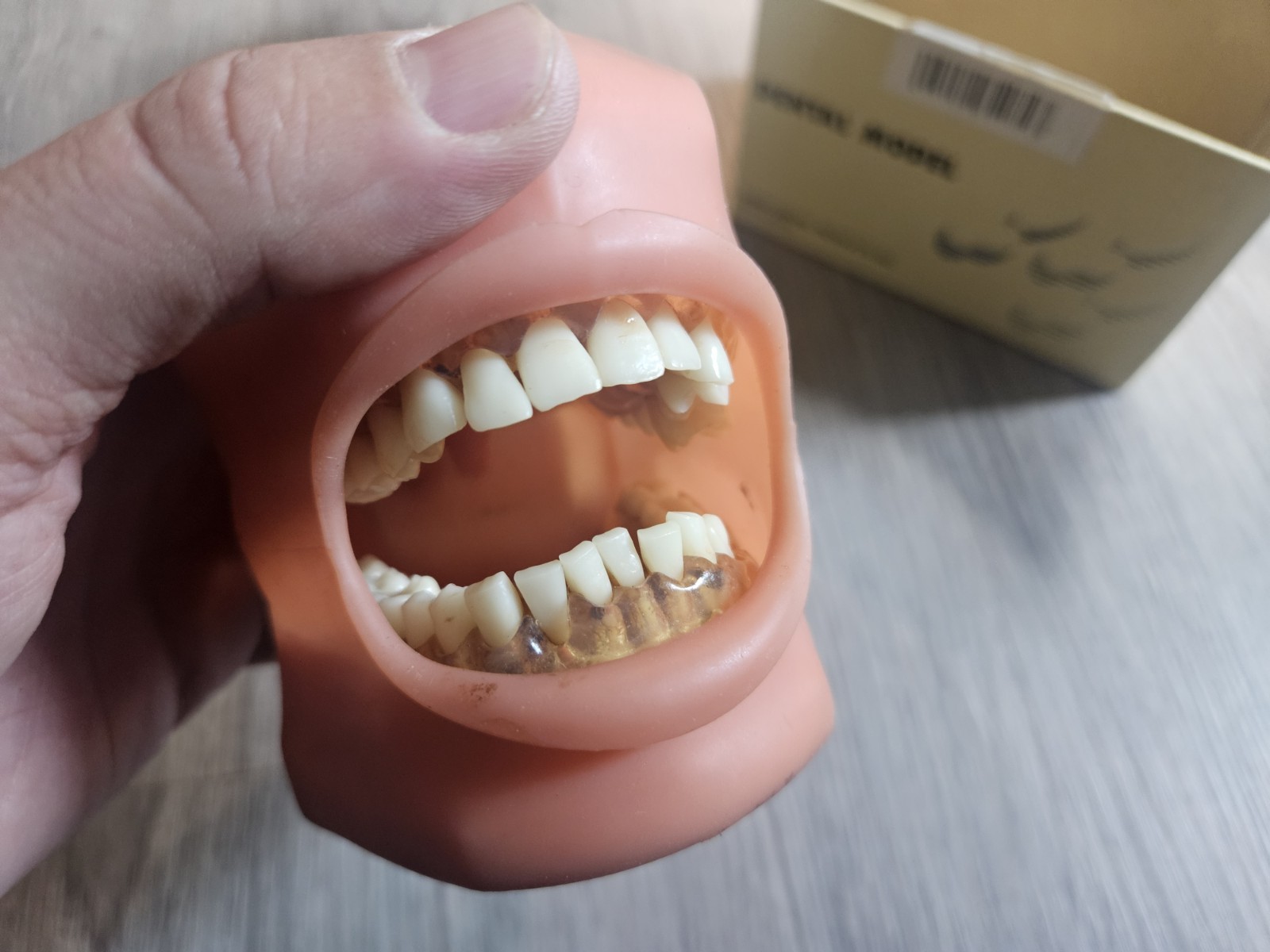 Nissin Dental Model – Kilgore International Inc. P15DP-TR.56C.1 GSD + B2-306