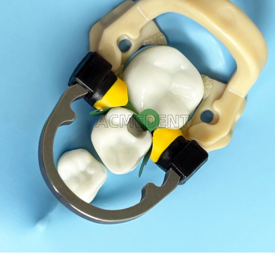 Pediatrics Dental Titanium Ring Matrix Clamp Kids Clip NITI Seperator Children