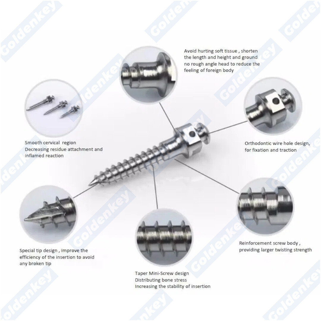 10PC Dental Orthodontic Screws Mini Implants Micro Screws Titanium TAD US STOCK