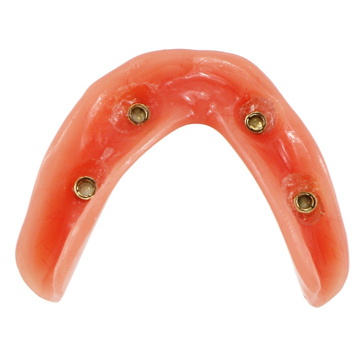 Dental Implant Teeth Model 4 Implants Upper/Lower Overdenture Restoration Model