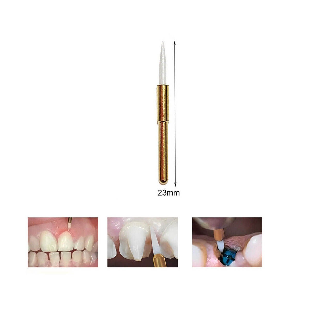 Dental Surgical Soft Tissue Trimmer Ceramic Bur 21/23mm Gingival Gingivectomy