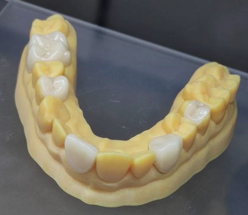 B40 LT CEREC Dental Glass Ceramic Blocks Lithium Disilicate CAD/CAM 4Pcs/Box