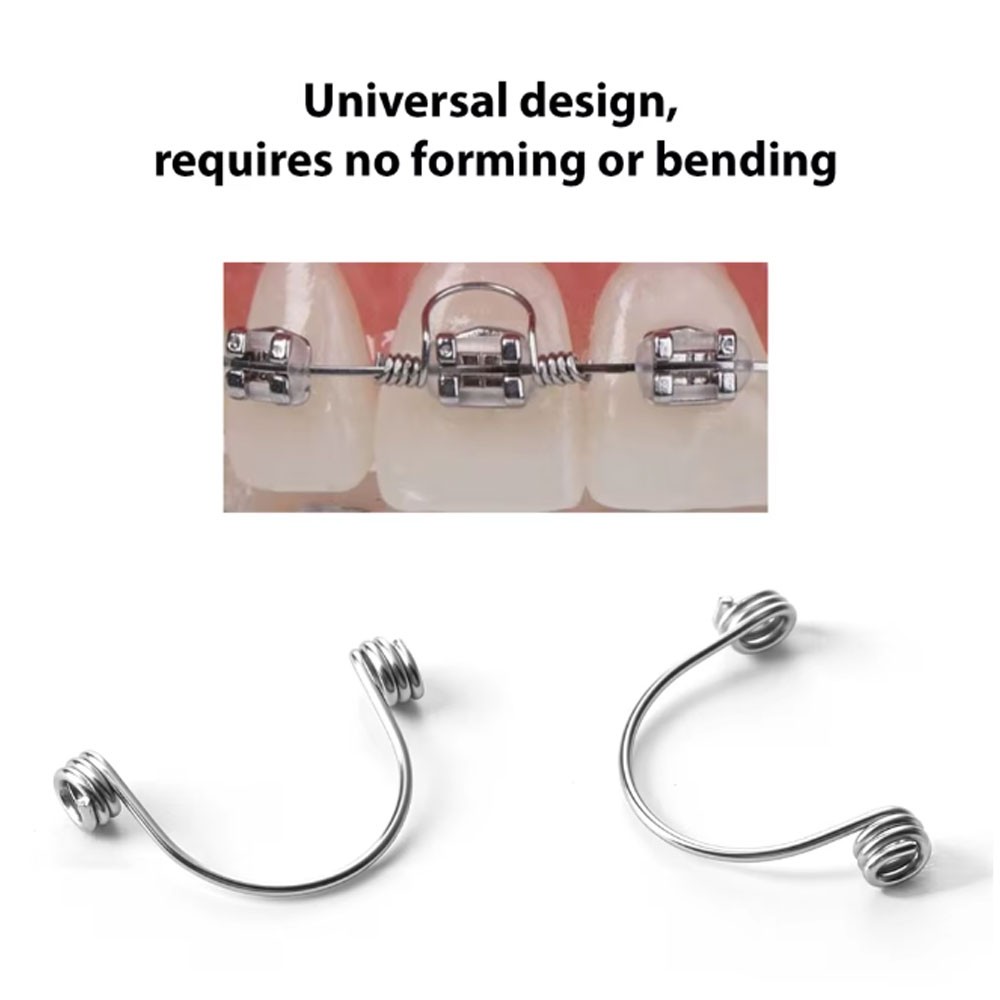 100pcs Dental Ortho Self-Lock Separating Springs Separate Steel Separator Spring