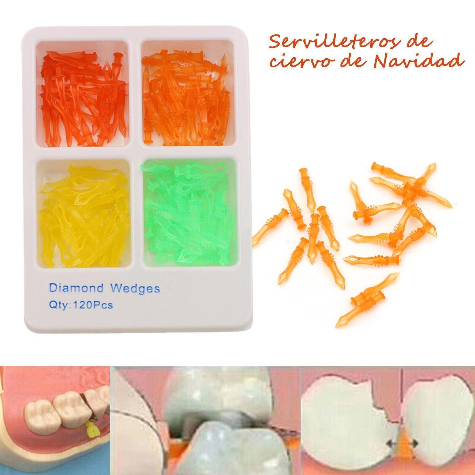 Dental Diamond Wedges Matrix Plastic Adaptive Interdental Teeth Wedge 120Pcs