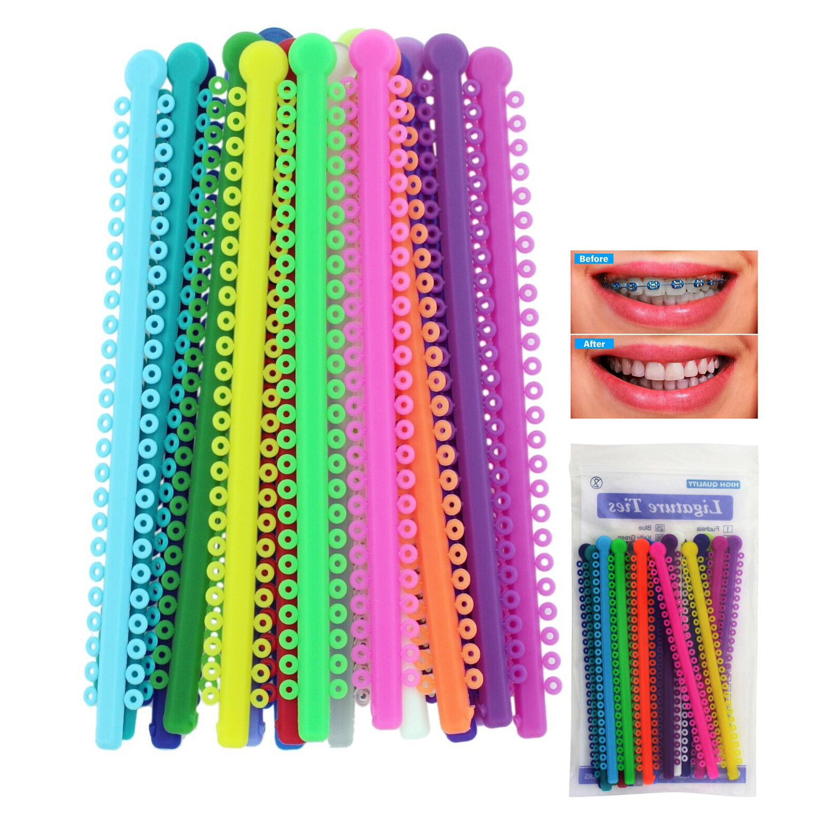 1000PCS Dental Orthodontic Ligature Ties Elastics Braces Rubber Band Ligaduras
