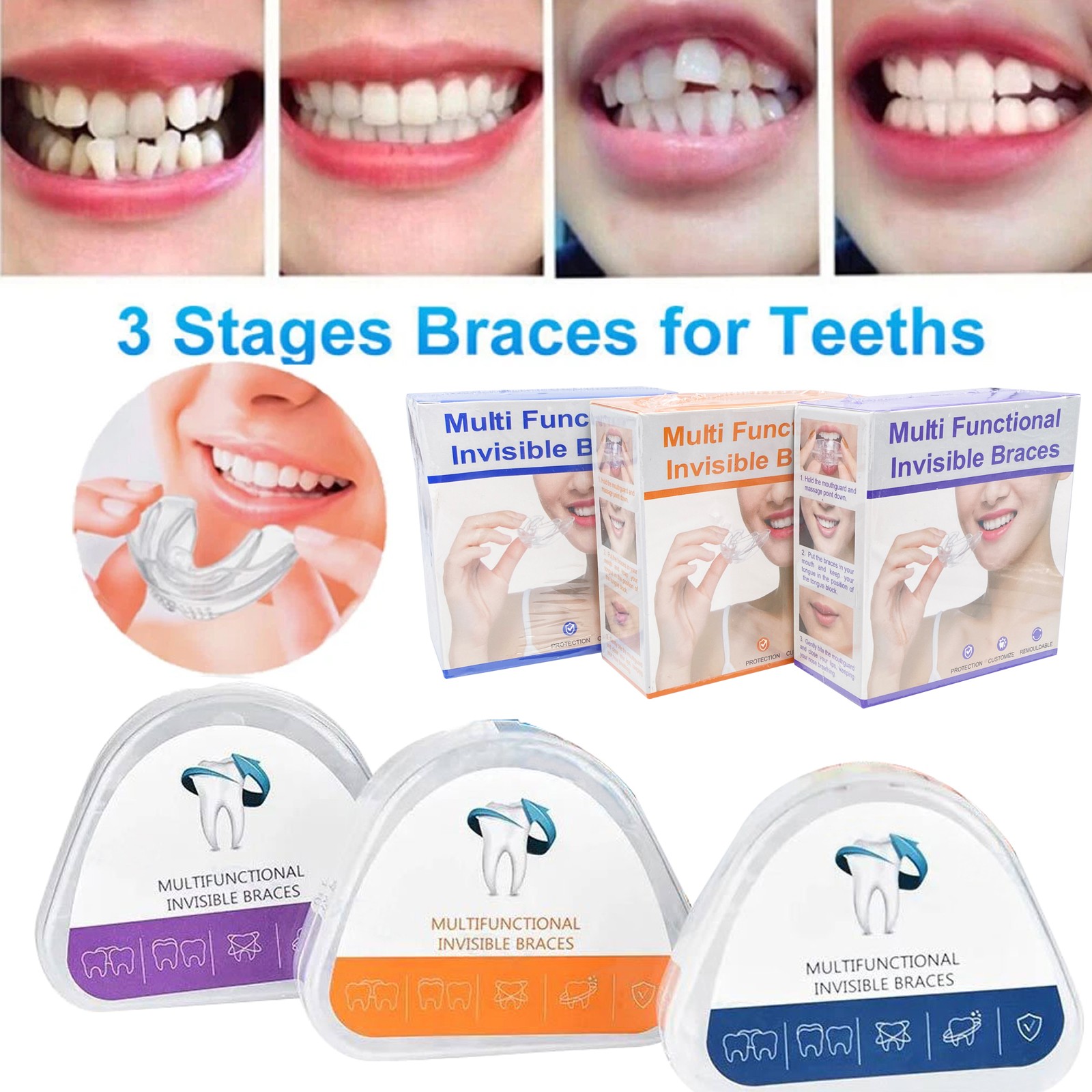 Dental Multifunctional Invisible Braces Orthodontic Smile Teeth Alignment Traine