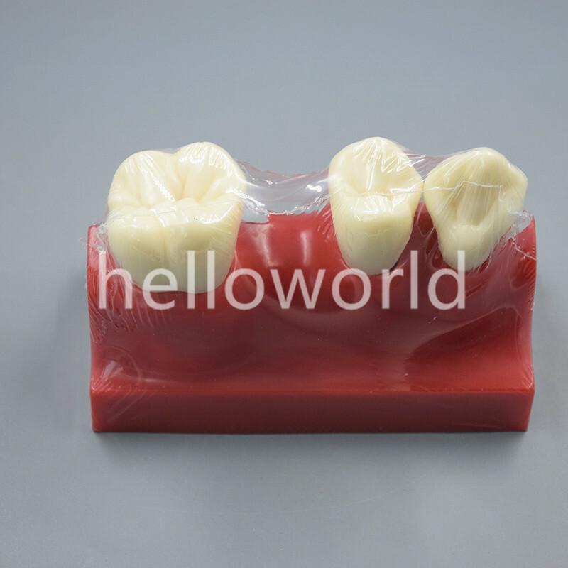 Dental Endodontic Study Teeth Model 4 Times Tooth Anatomy Anatomical Models