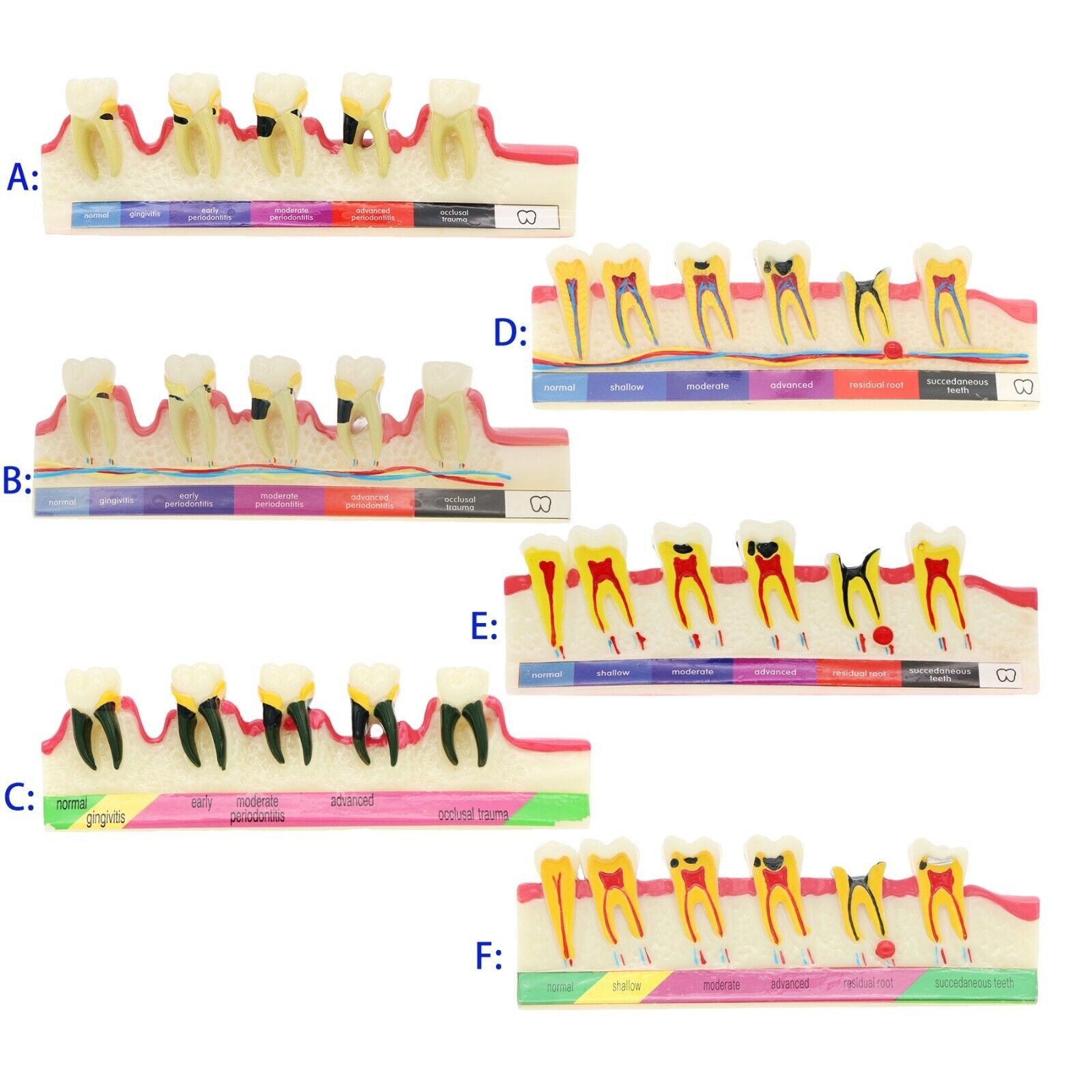 Dental Multiple Types Teaching Teeth Model Typodont Ortho Implant Practice Demo