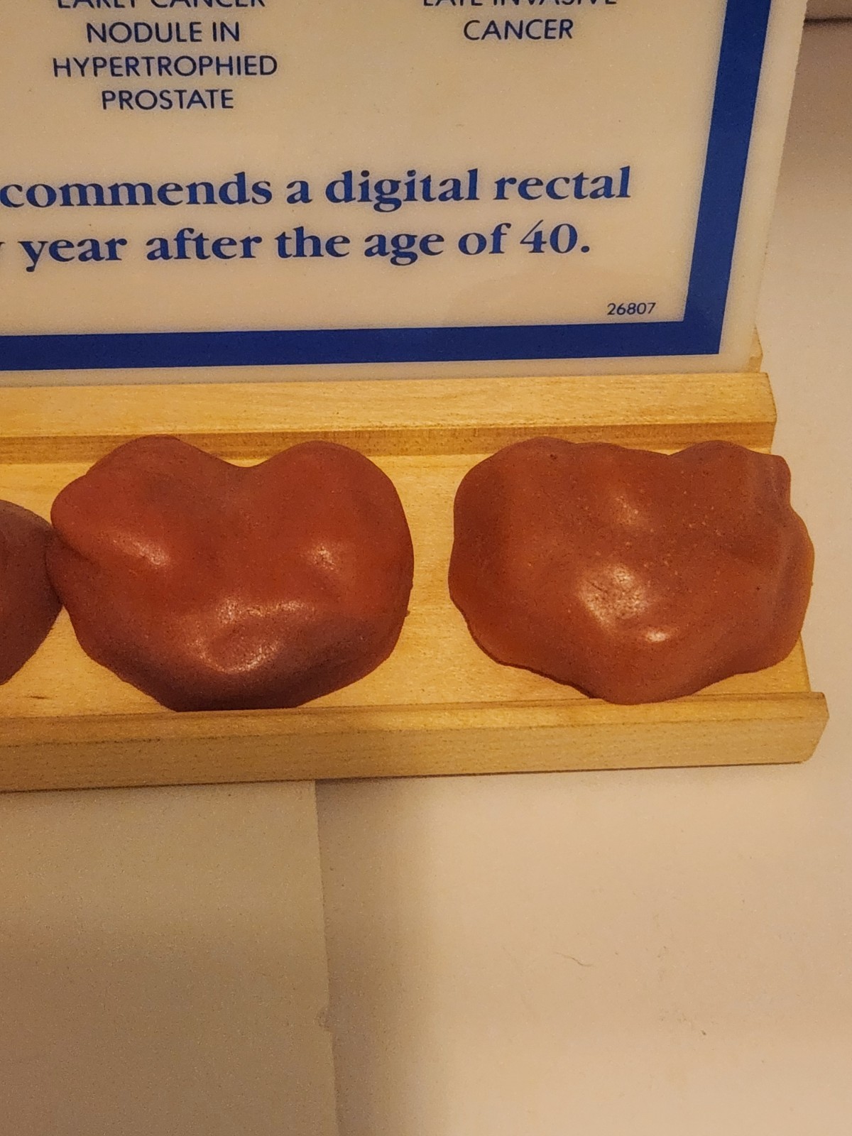 Prostate exam chart and touch