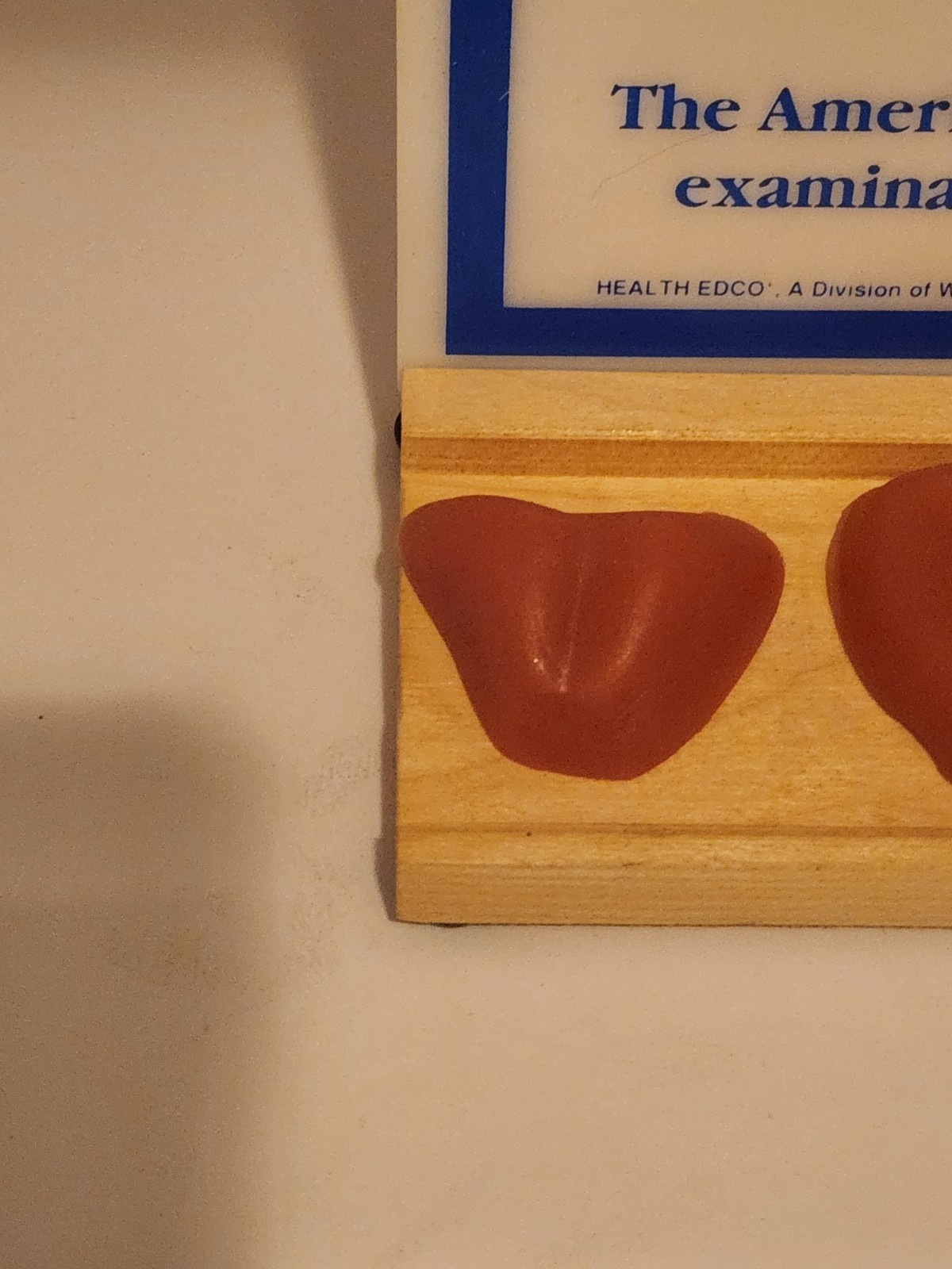 Prostate exam chart and touch