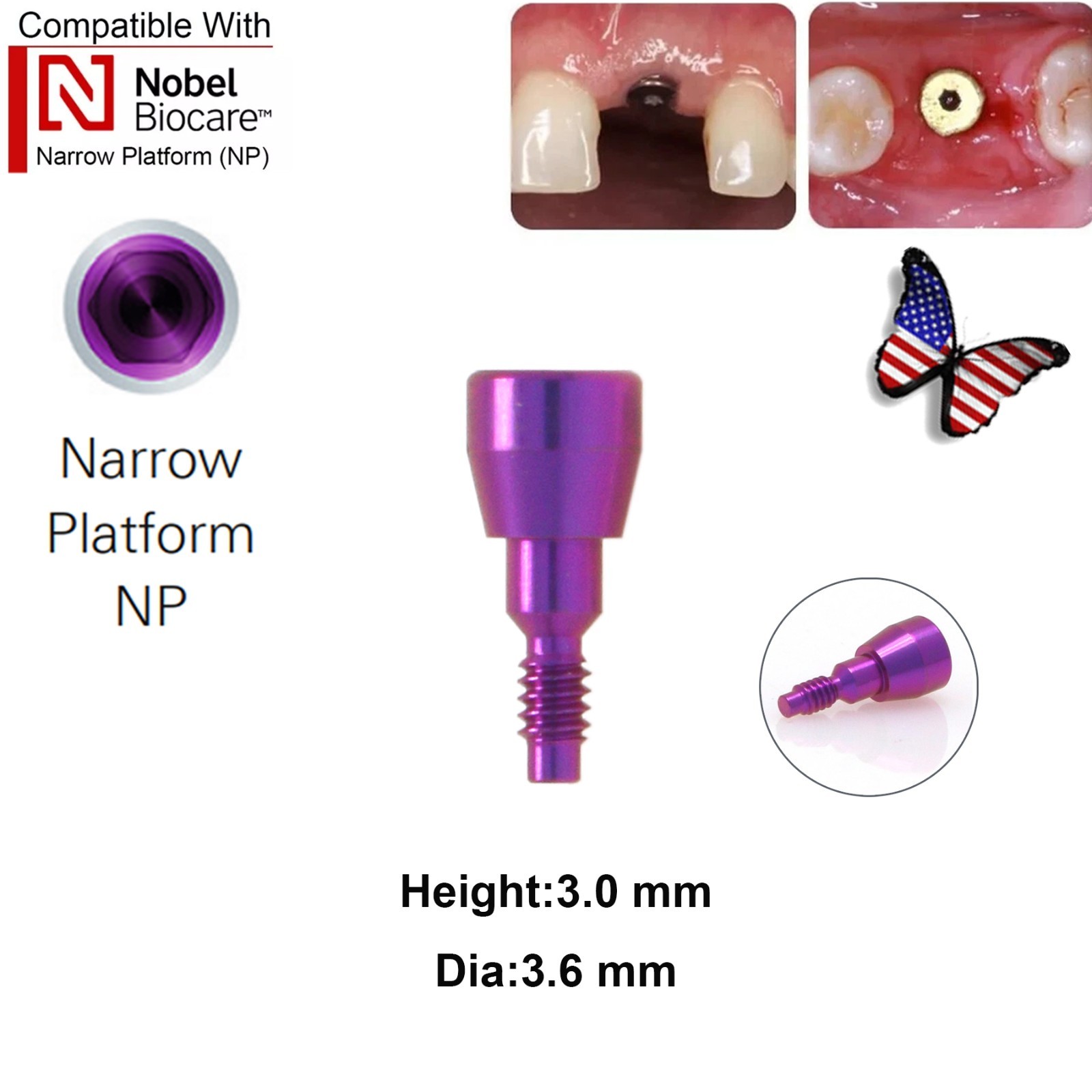 5Pcs Nobel active Healing Abutment Cover Screw Healing Screw Gum Molding Implant