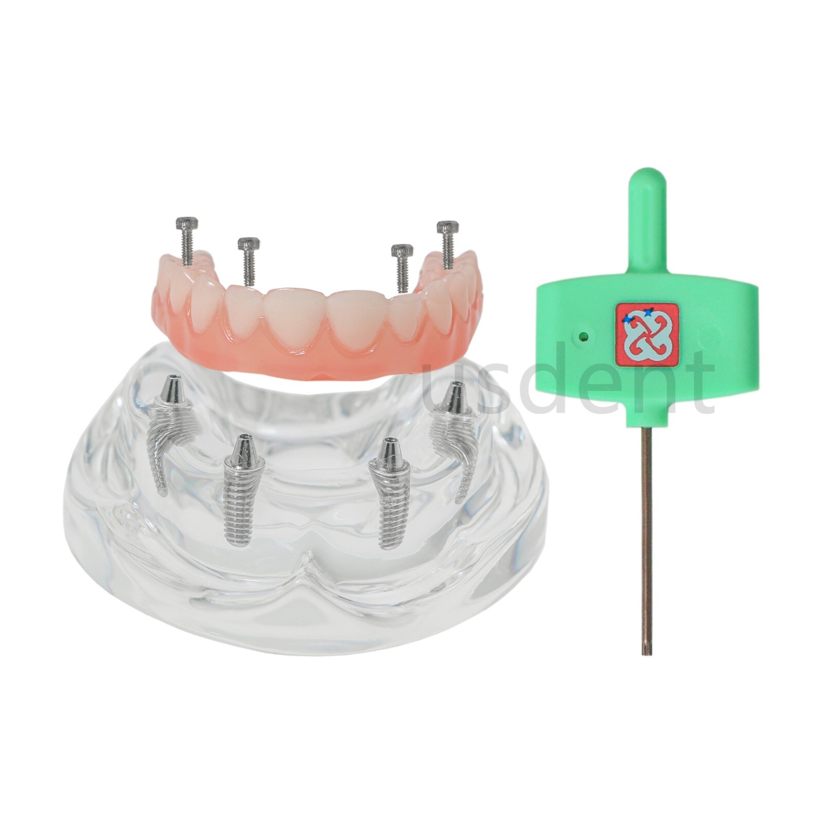 All on 4 Dental Implant Model Overdenture Upper Jaw 4 Implant Clear Detachable