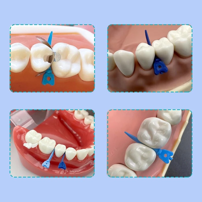 Dental Sectional Matrix System Matrix Bands Clamp Ring Palodent V3 Tulwar Wedges
