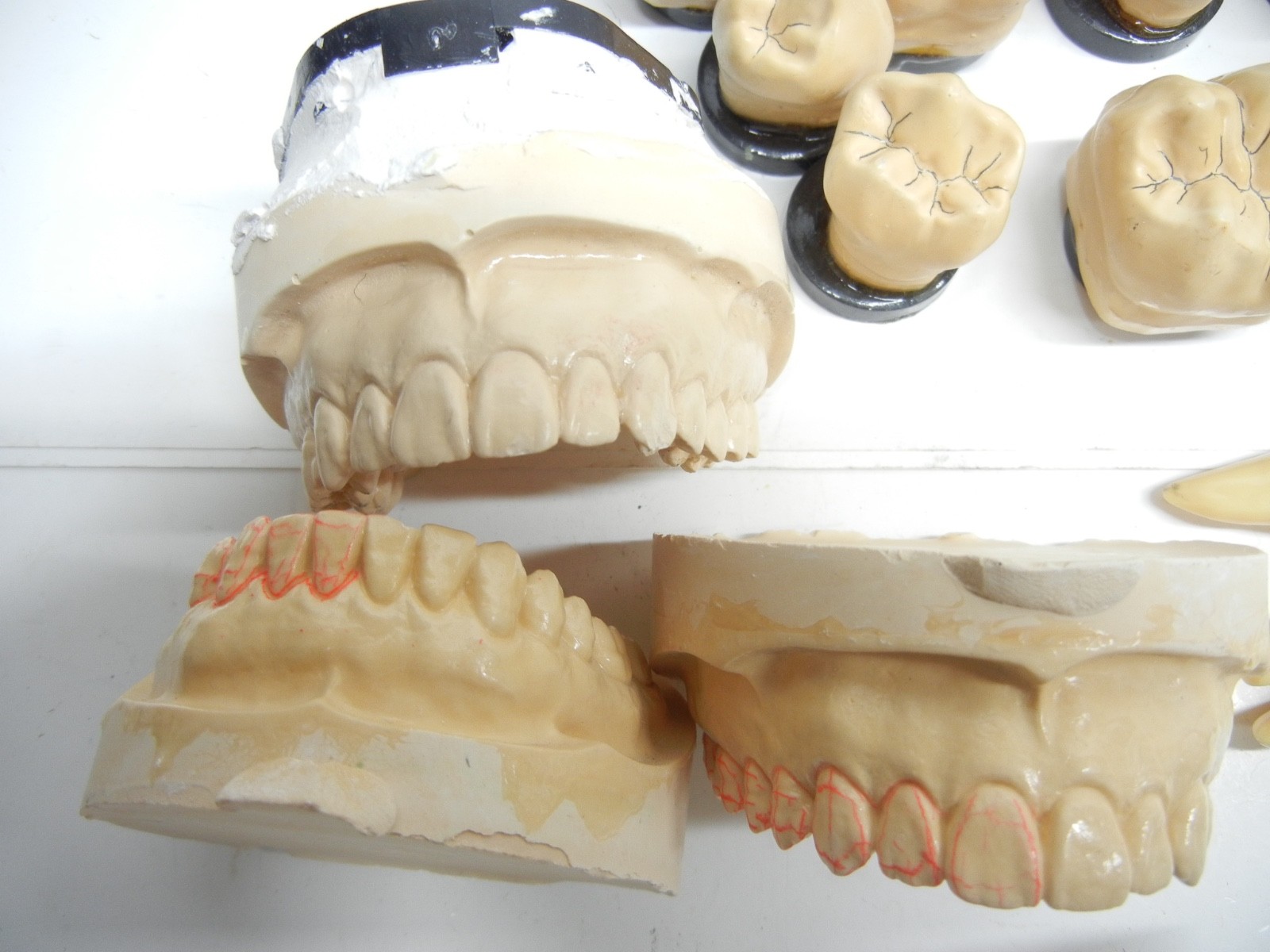 Dental study models and Study Teeth
