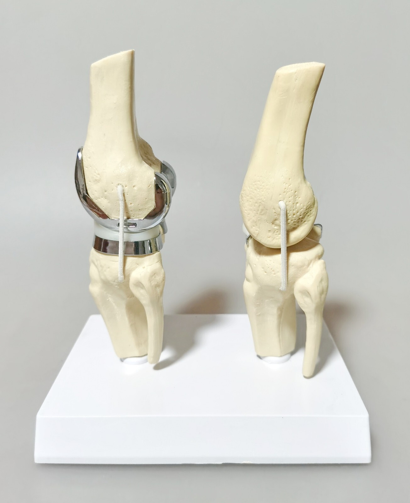 Detachable Artificial Knee Prosthesis Medical Anatomical Teaching Demo Model